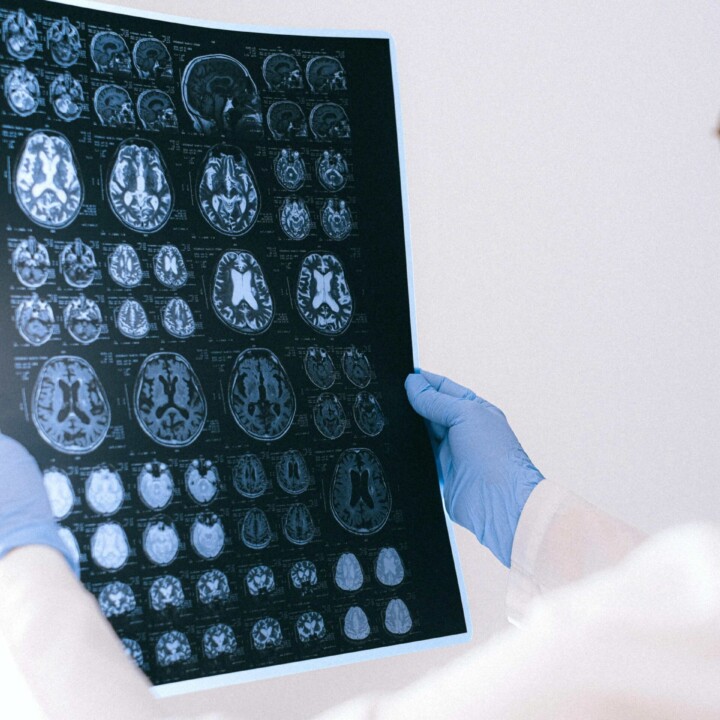 Neuropsychologist (Neuropsikolog)